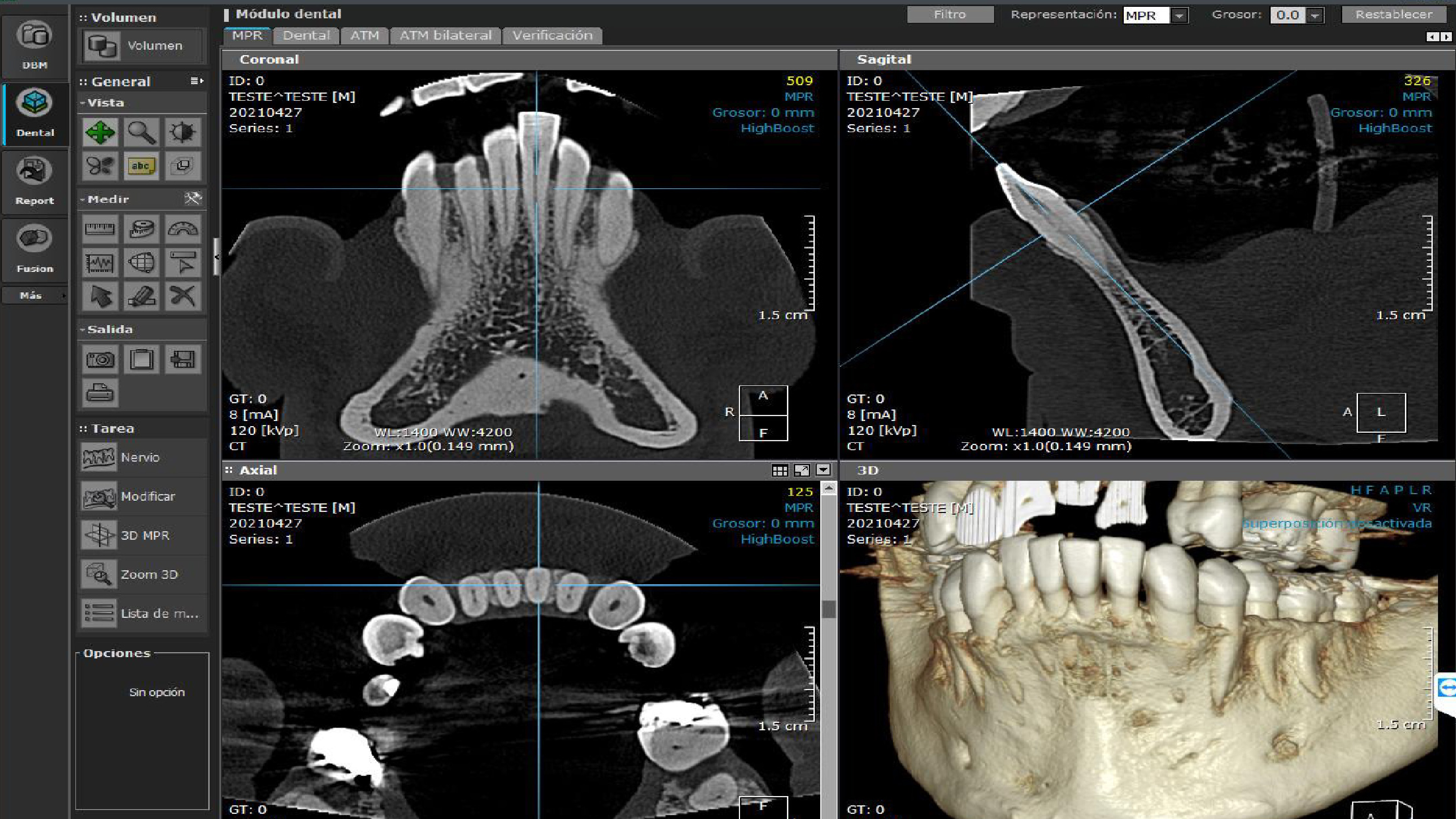 Tomografía Volumétrica 3D (CBCT)